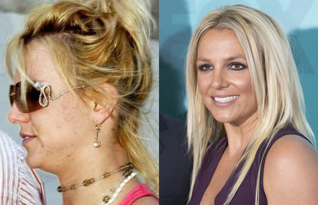 30 Shocking Photos of Hot Celebrities Without Makeup or Photoshop