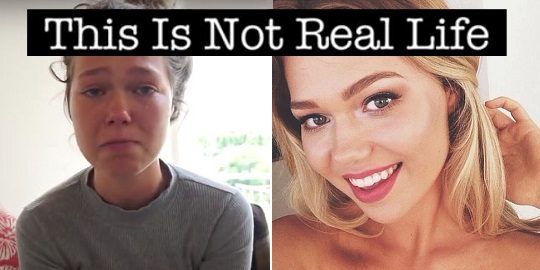 18-Year-Old Model Edits Her Instagram Posts To Reveal The Truth Behind The Photos