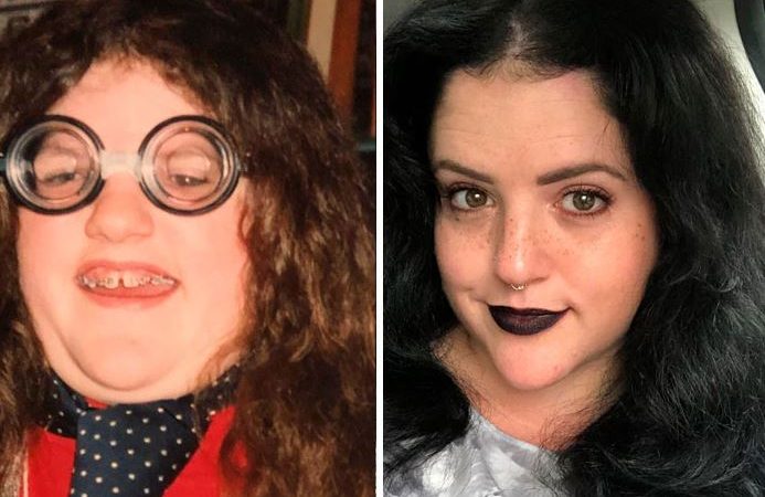 “Ugly Ducklings” Share Their Transformations and They are Hardly Recognizable